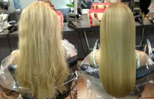 before and after professional hair restoration