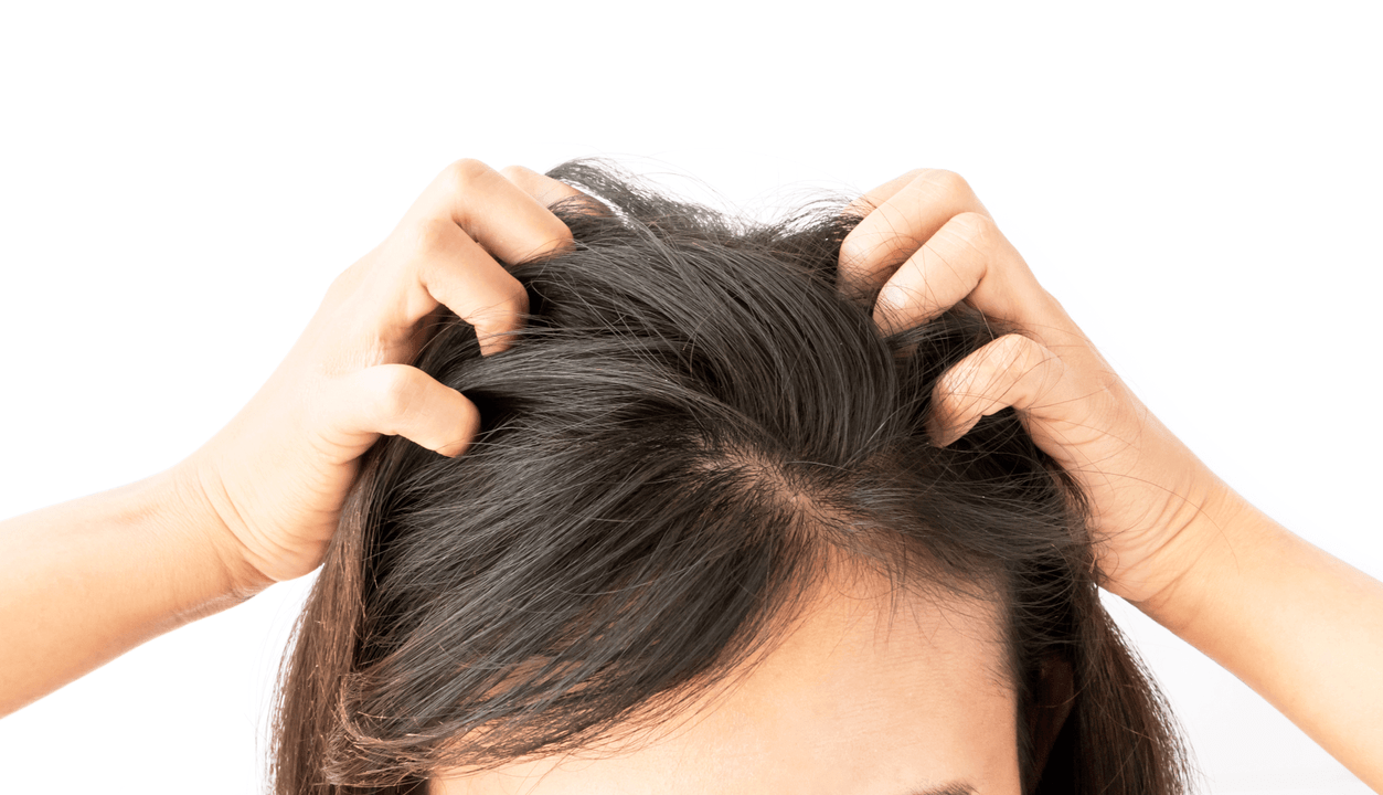 dry scalp and treatment with a spray Verdexedil
