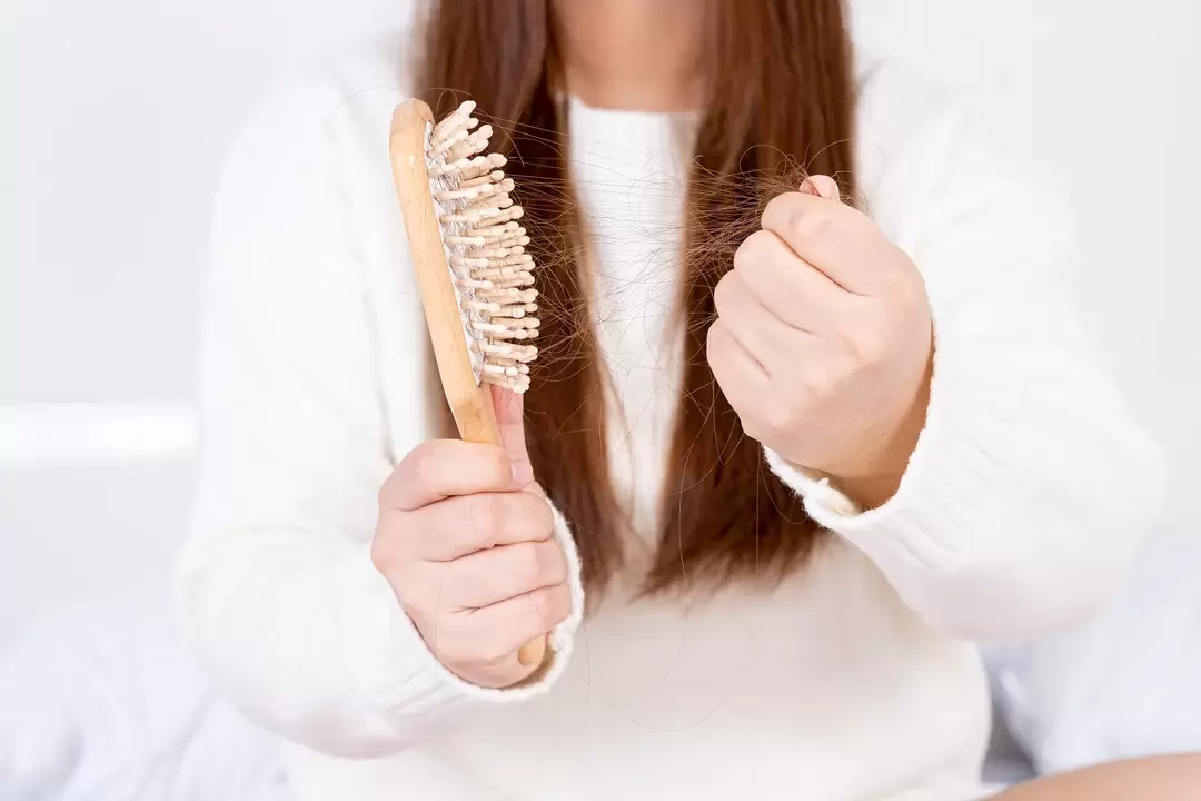 hair loss and treatment with a spray zxcvbnmqwort